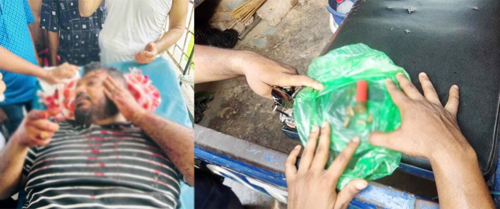 খুলনায় দিনে-দুপুরে ট্যাংকলরি নেতা ফরহাদসহ ৩ জন গুলিবিদ্ধ 8 17 6